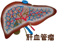 妇科图片